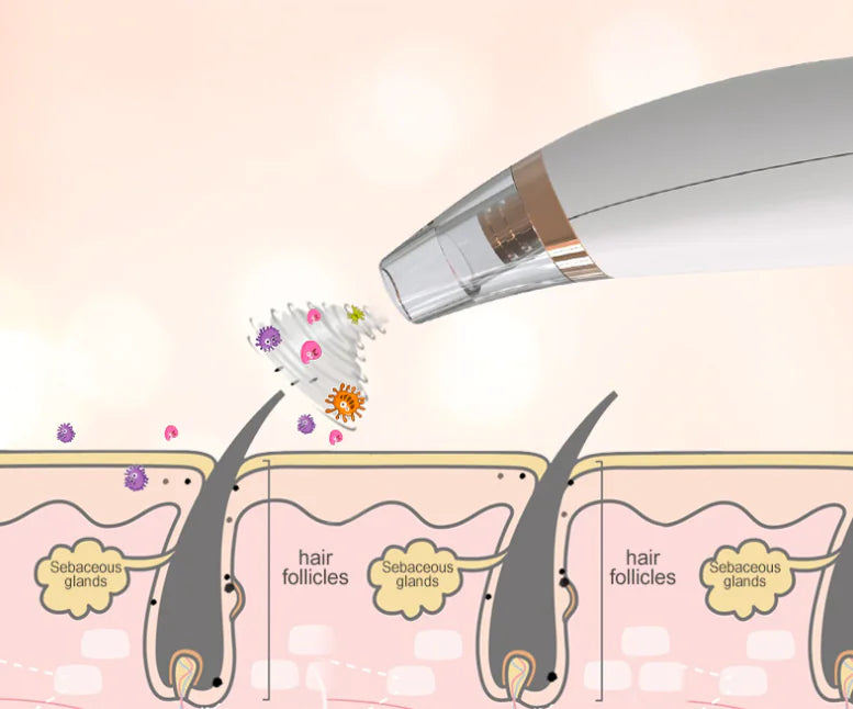 Blendnatura Pore Vacuum Blackhead Remover